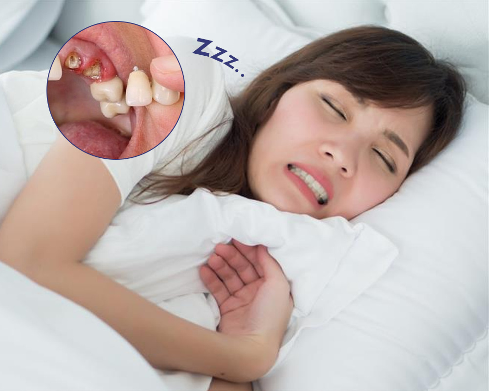 Nằm Mơ Thấy Rụng Răng Giải Mã Điềm Báo Và Con Số May Mắn 4 Ý nghĩa của việc nằm mơ thấy rụng răng